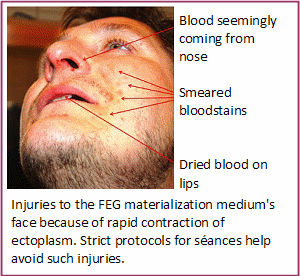 (c) FEG2011-ectoplasm_enjury